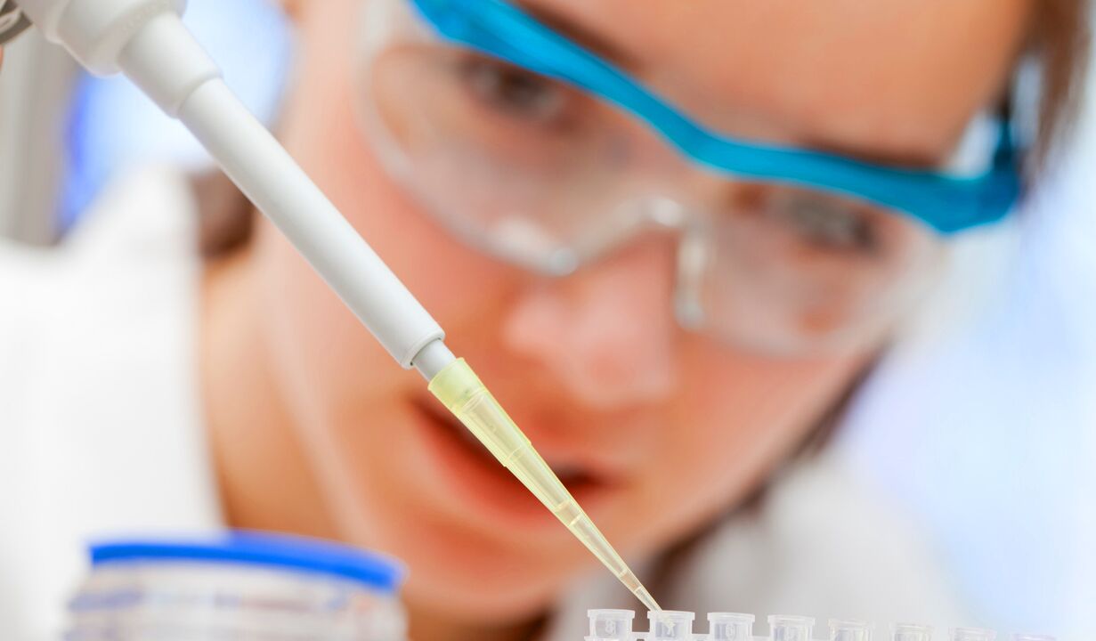 Laboratory analysis of urine - a method for diagnosing prostatitis